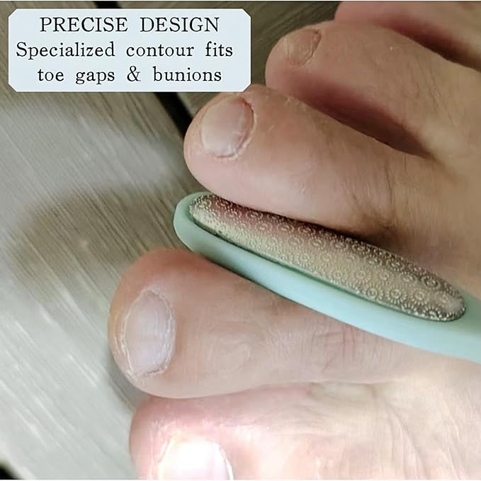Precision Callus Remover & Bunion Scrubber for Toe Gaps, Hard Skin, and Corns – Mini Foot File Exfoliator with Compact Design for Pedicures and Sensitive Areas