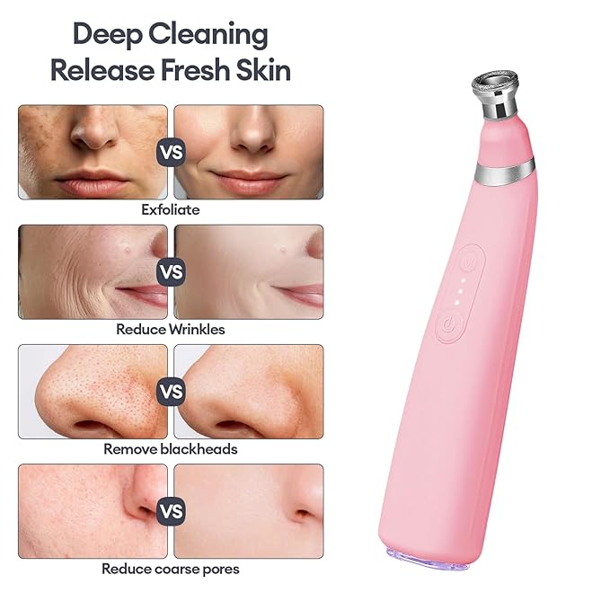 IeBilif Diamond Microdermabrasion Machine, 3 Modes Diamond Microdermabrasion Dermabrasion Machine for Blackhead Removal, Professional Portable Home Travel Microdermabrasion Device