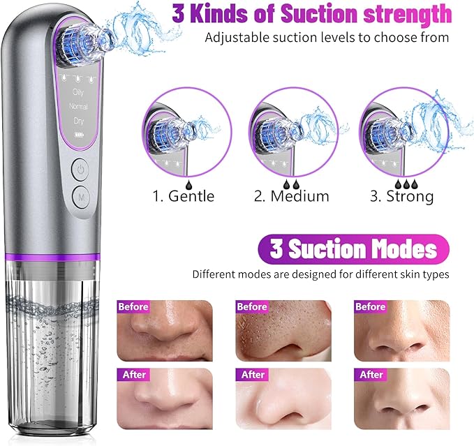 Blackhead Remover Suction Pore Vacuum Hydro Facials Hydrating Pore Cleaner Machine Pimple Extractor with USB Charging Cable Beauty Device
