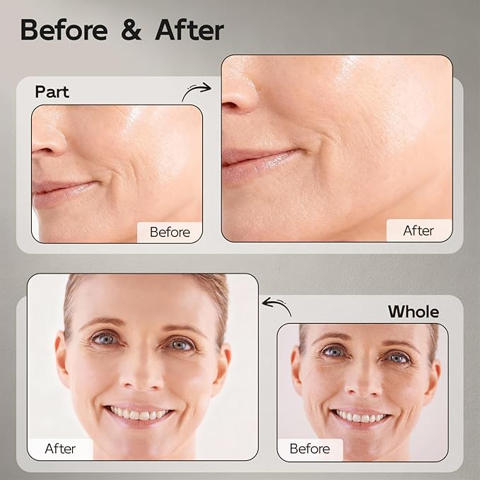 Retinol Serum for Face & Neck, Anti Aging B5 Resurfacing Face Serum with Niacinamide + Collagen + Hyaluronic Acid, Smooths Wrinkles & Fine Lines, Dark Spot Corrector, Brighten Dullness