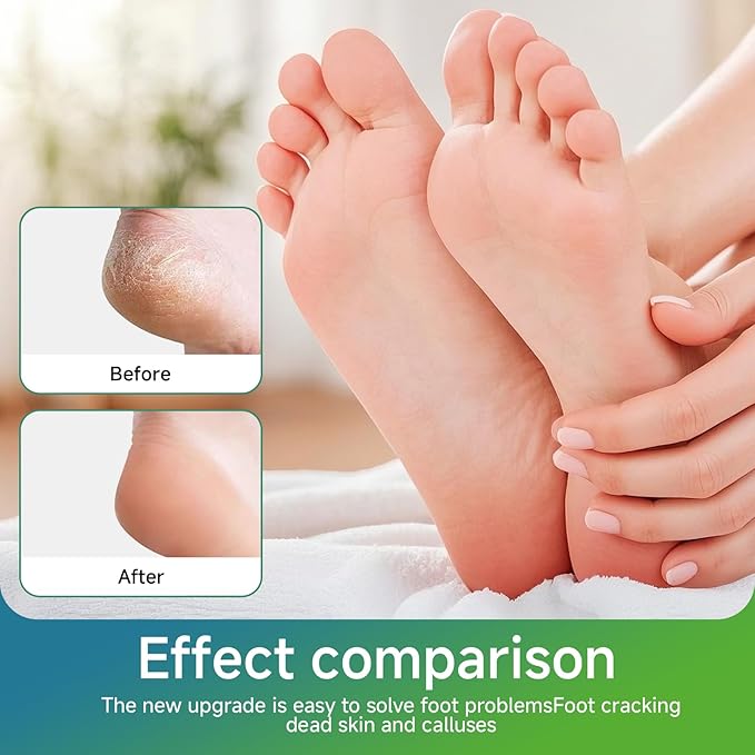 Nano Glass Foot File Callus Remover, Beyond The Cream Foot File,NanoGlass Feet File Professional Hard Skin Remover with Non-Slip Ergonomic Handle (Blue,1Pcs)