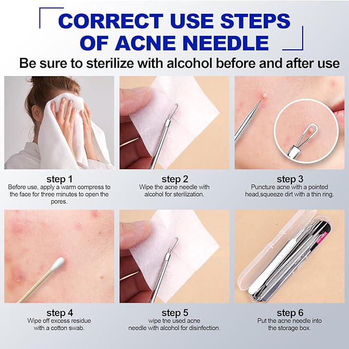 Blackhead Remover Pimple Popper Tool Kit 10PCS Professional Stainless Steel Blackhead Tweezers,Pimple Extractor for Removing Pimples, Zit on Face - Acne Removal Kit with Case Magnifier