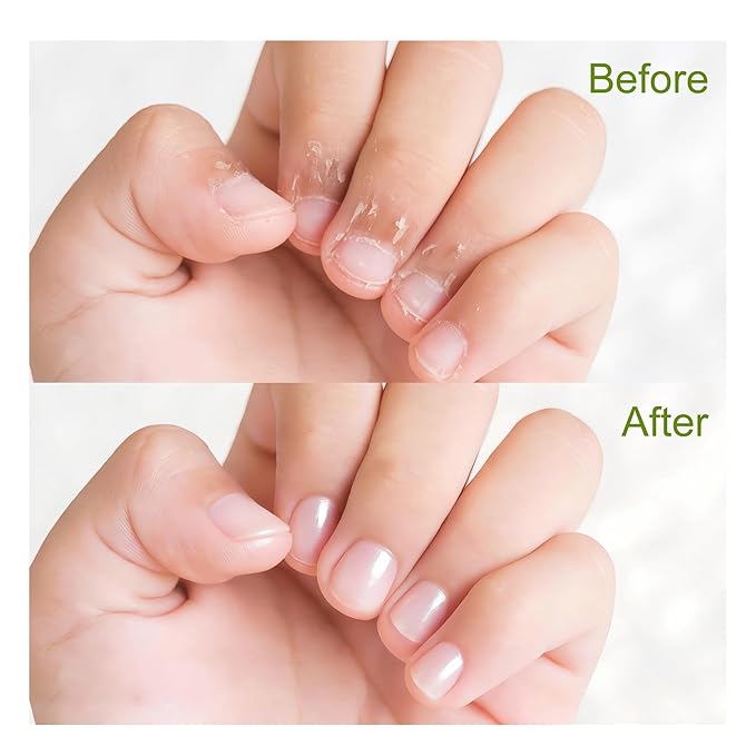 NOVAL Roll on Cuticle Oils with Tea Tree Oil, Easy Rollerball Application, Fresh Mint Scent, Nail Moisture, Natural Ingredients, 0.34fl.oz