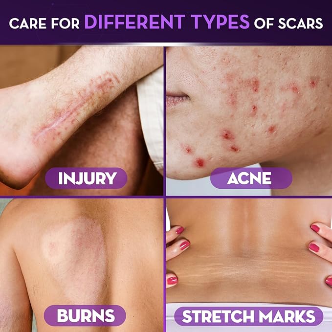Cicatricure Advanced Scar Gel for Face & Body - Proven Results in 2 Weeks, Scar Treatment for Surgical Scars, Stretch Marks, Scars of Burns and Injuries, Acne Scar Treatment, 1 oz (28 g) - Pack of 2