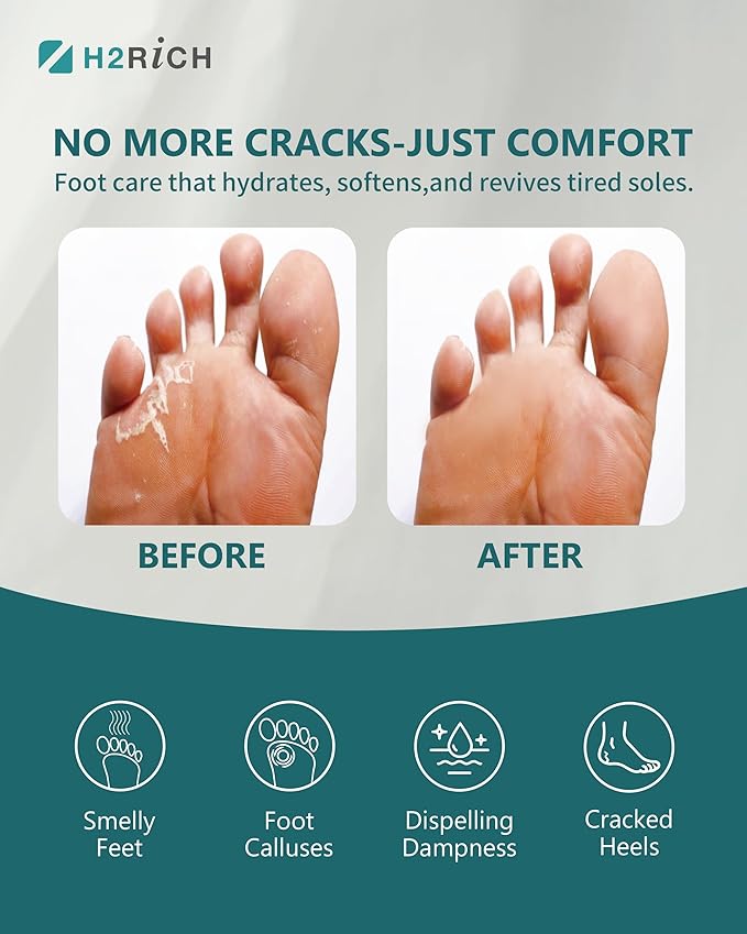 Hydrogen Foot Soak Effervescent Tablets 2 Pieces | Ginger & Mugwort Herb Foot Bath, Relaxing Spa Pedicure Care | Improves Circulation, Soothes Tired Feet, Softens Calluses, Controls Odor
