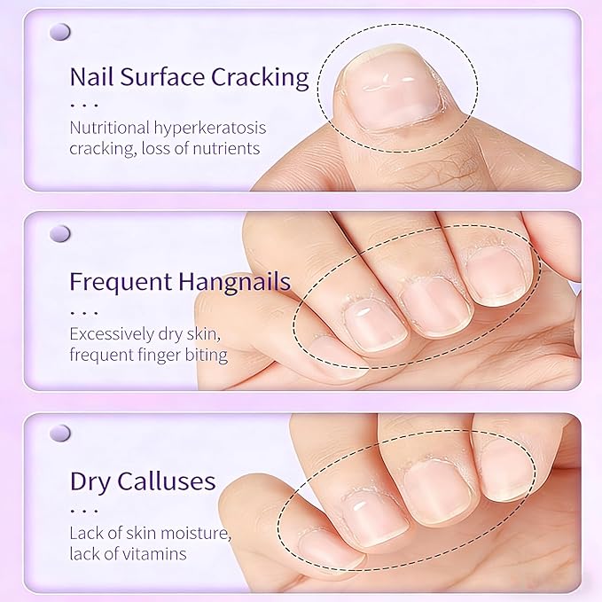 3-in-1 Nail Care Pen Set, 3Pcs Cuticle Oil Pusher Pen with Ceramic Tip, Nail Oil Pen for Dry Cuticles & Hangnails, Moisturizing Nail Conditioning Pen for Nails