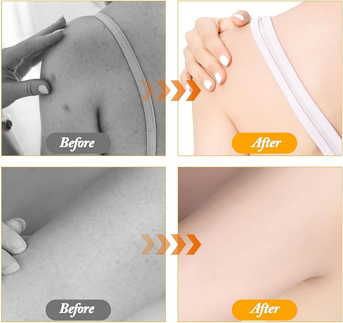 2Pcs Upgrade 2-in-1 Sunflower Bath Ball,Super Soft Sunflower Suction Cup Bath Ball，Bath Loofah with Suction Cup, Exfoliating Bath Sponges for Shower Women Men(Beige+Purple)