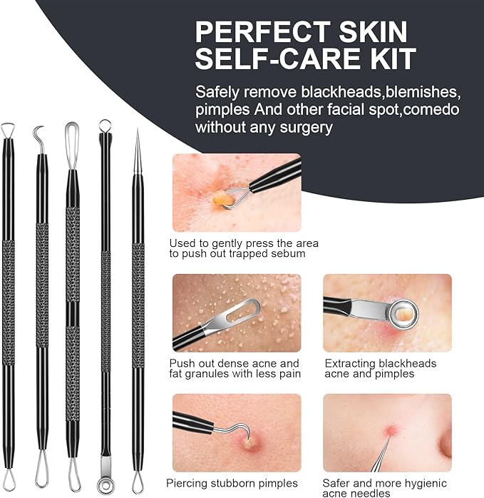 Pimple Popper Tool kit Blackhead Remover Comedone Extractor Kit with Box for Easily Remove blackheads, Acne, Blemishes, Whiteheads, pimples and Papules from the face and Bonus Gift -7pcs