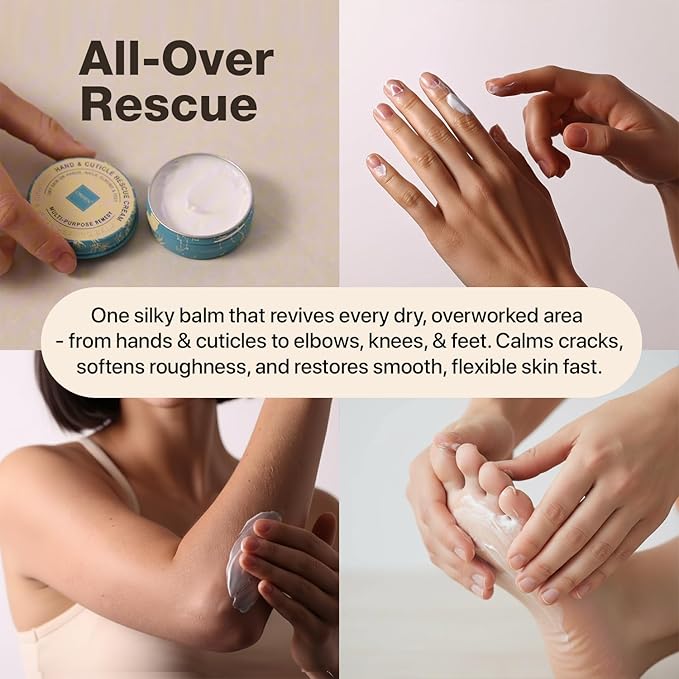 Onsen Hand & Cuticle Rescue Cream | Organic Nail Strengthener & Balm | Dry, Cracked Hands, Elbows & Feet | Shea Butter, Tsubaki & Jojoba Oil | Nail Repair & Growth, Vegan – 1 Pack (1.10 oz)