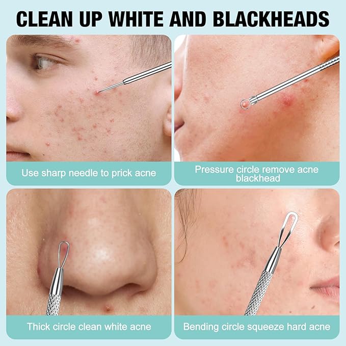 3Pcs Blackhead Remover Pimple Popper Tool Kit Pimple Extractor Acne Treatment Surgical Grade Blackhead Comedone Removal Popper Tool Cleaning Brush for Face Nose Lips