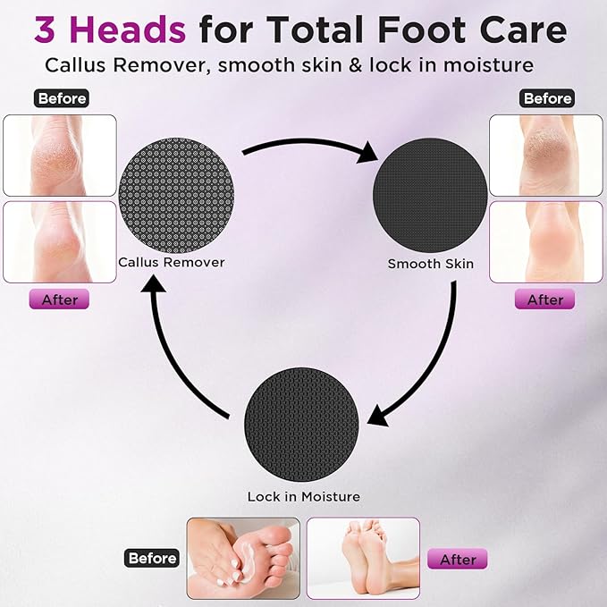 Electric Foot Callus Remover, Apply Oil,Foot SPA, Foot File,Reusable Nano-Glass Head, Ergonomic Premium Aluminum Callus Remover for feet, Rechargeable Pedicure Tools for Feet,Gifts for Men Women