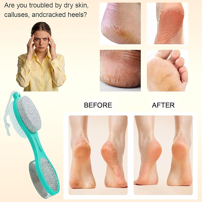 Foot File Callus Remover 5-in-1, 2 Pcs Feet Scraper Pedicure Tools with Pumice Stone, Scrubber Brush, Stainless Steel Foot Rasp and Sand Paper Debris Catcher, Multi Purpose, Pink Cyan