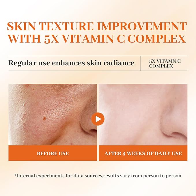 Premium 5X Vitamin C Face Serum 30ml - Vitamin C Serum with Niacinamide, Hyaluronic Acid & Collagen, Hydrating & Firming Essence for Glowing Skin and Even Tone