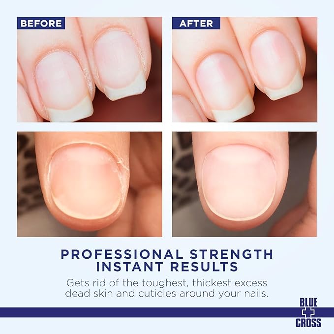 Cuticle Remover & Softener Liquid for Nails – Blue Cross Professional Nail Care with Lanolin, Hydrating Treatment for Dry Cuticles & Hangnails, Made in USA, 32oz
