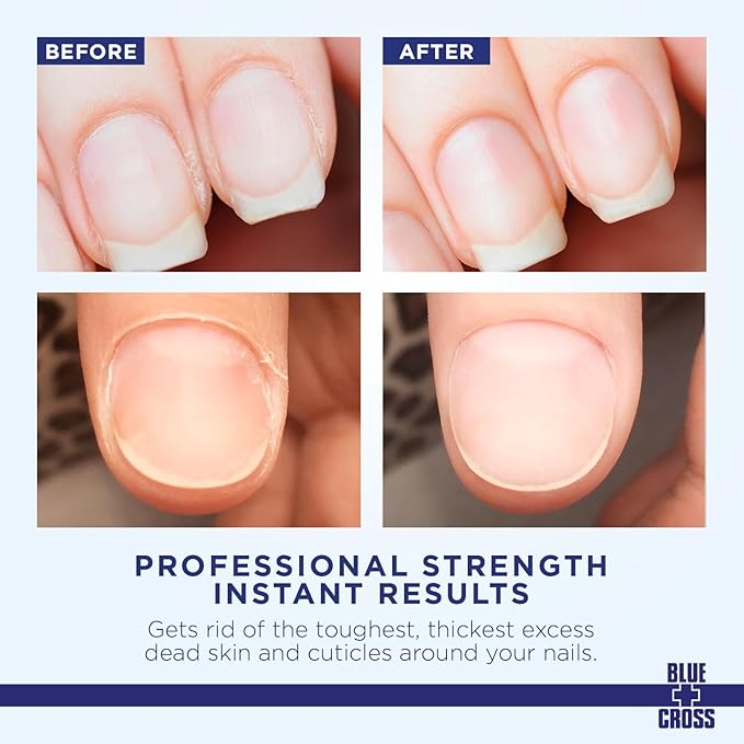 Cuticle Remover & Softener Liquid for Nails – Blue Cross Professional Nail Care with Lanolin, Hydrating Treatment for Dry Cuticles & Hangnails, Made in USA, 16oz
