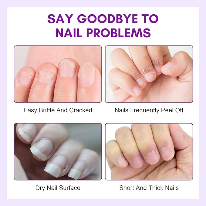 Makartt Cuticle Oil Pen Nail Care: Repair and Softener with Vitamin E, Moisturizer Kit for Acrylic Nails, Art Accessory for Manicure and Pedicure, DIY Home Salon Use