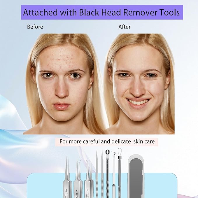 Blackhead Remover Vacuum Heat Visible, Pore Vacuum with Heating & HD Camera, Black Head Extractions Tool for Men and Women Pore Cleaner Facial Skincare Kits Set