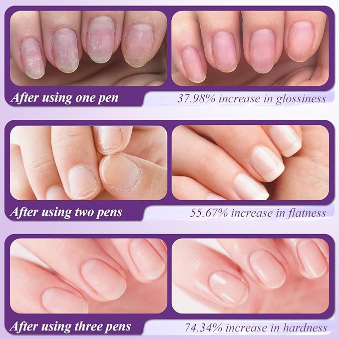 3-in-1 Cuticle Oil Pen, Cuticle Pusher Nail Oil Pen with Rotating Design, Nail Care Pen, Nail Buffer Pen for Hangnails, Dry and Damaged Nails, Moisturize Strengthen Daily Nails Care (3PCS)