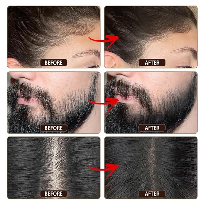 VOLLUCK Root Touch up Powder, Instant Hairline Powder for Thinning Areas and Gray Hair Coverage, Natural and Non-greasy Root Cover up for Women and Men (Gray, 0.35 Ounce)