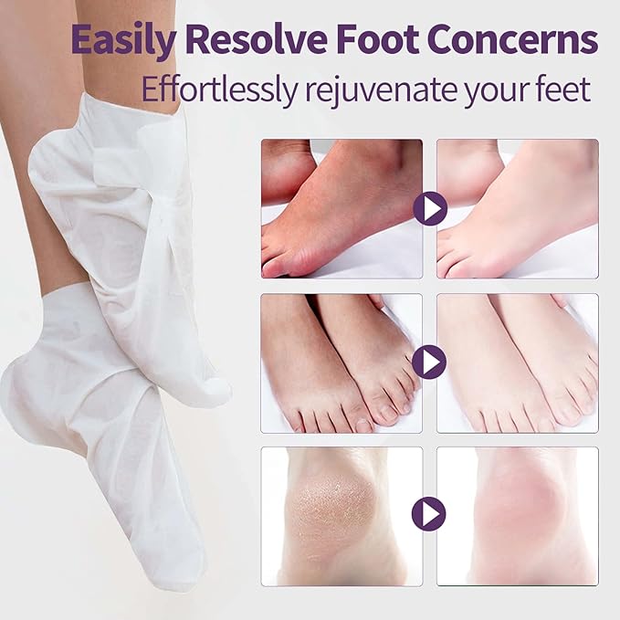 5 Pack Moisturizing Foot Mask,Hydrating Foot Masks for Dry Cracked Feet,Moisturizing Socks Dry Skin Moisturizer for Soft and Smooth Touch Feet,Foot Care Spa Gifts for Women Men Easter Basket Stuffers