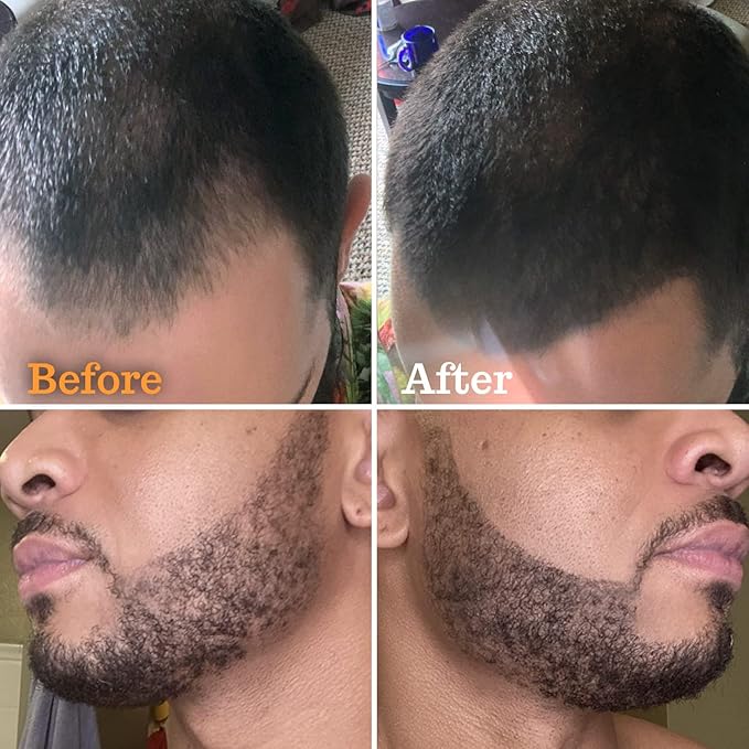 Beard Pen Filler for Men - Barber Styling Grooming Pencil - Waterproof, Sweat Proof, Long Lasting Solution with Natural Finish - Cover Beard and Scalp Patches in Seconds - Dark Brown 5 Pack