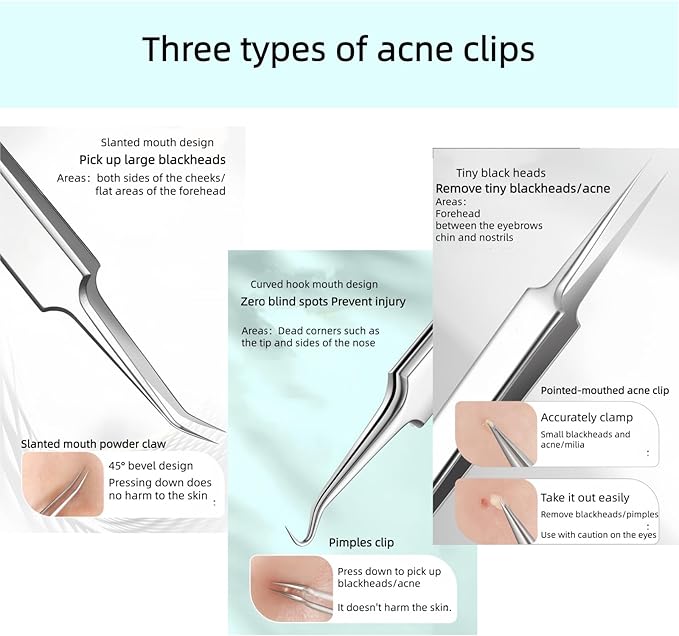 4 Pcs Blackhead Remover Comedone Extractor, Acne Removal Kit, Manual Pimple Popper Tool for Quick and Easy Removal of Pimples, Blackheads on Forehead, Facial and Nose (Standard 4 Pack)