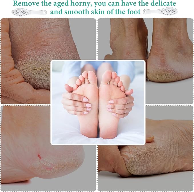 2 Pcs Stainless Steel Foot Scraper Metal Foot File Double Sided File Callus Remover Professional Feet Rasp Scrubber for Wet or Dry Skin Easy to Clean Pedicure Tool Heel