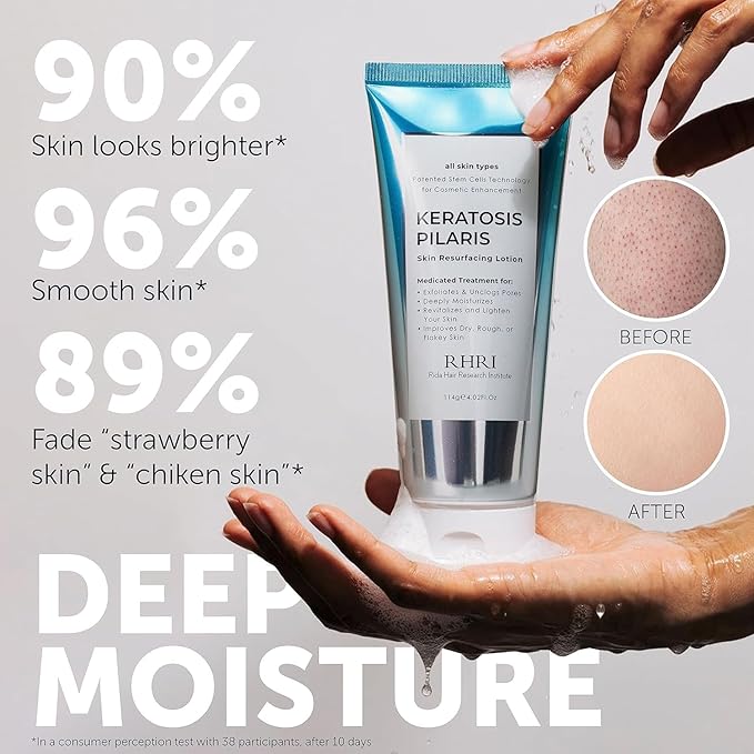 KP Bump Eraser Body Scrub with 10% AHA | Keratosis Pilaris Treatment | Bump Eraser Body Scrub | Ingrown Hair Treatment | Clears Strawberry Legs | Soothes Redness, Dryness & Flaky Skin
