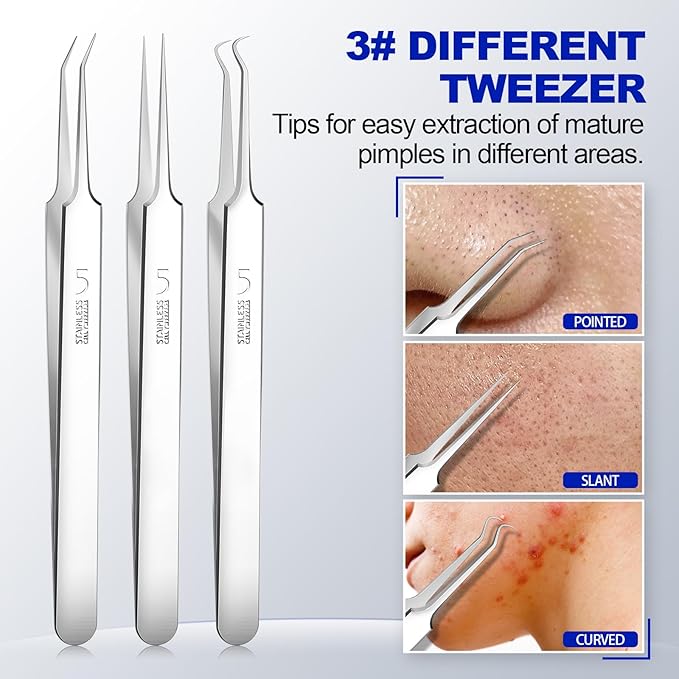 Blackhead Remover Pimple Popper Tool Kit 10PCS Professional Stainless Steel Blackhead Tweezers,Pimple Extractor for Removing Pimples, Zit on Face - Acne Removal Kit with Case Magnifier