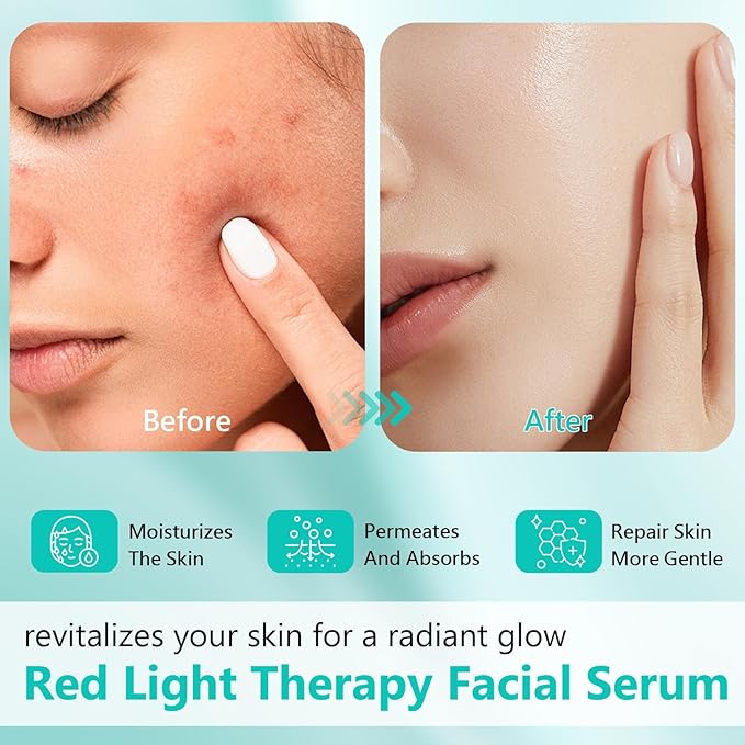 Red Light Therapy Activation Serum, Red Light Therapy Serums for Face and Neck, Hydrating Serum for Face, Facial Serums Anti Aging and Reduce Wrinkles, Pure Formula Facial Serum for Women, 1OZ