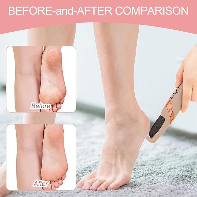 LQT® Electric Foot File – Rechargeable Callus Remover for Hard, Cracked Skin – At-Home Pedicure Kit for Smooth Feet (Men & Women) (Pink)