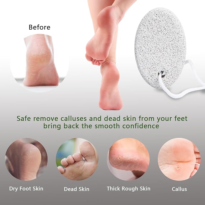 4-Pack Natural Pumice Stone for Feet, Borogo Lava Pedicure Tools Hard Skin Callus Remover for Feet and Hands - Natural Foot File Exfoliation to Remove Dead Skin, Heels, Elbows, Hands