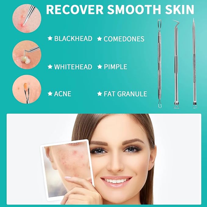 WSYUB Pimple Popper Tool, Stainless Steel Pimple Extractor, WSYUB Blackhead Tweezers, Comedones Extractor Acne Removal Kit for Blemish, Whitehead Popping