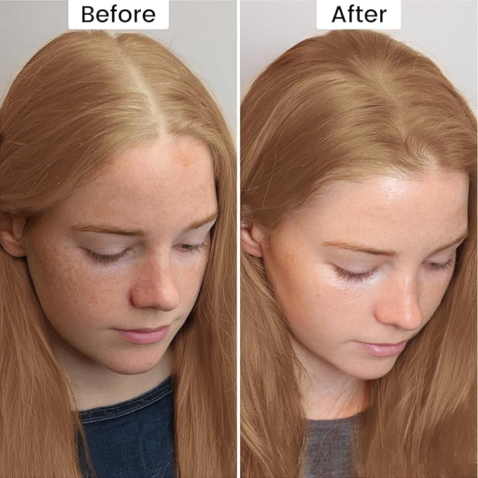 VOLLUCK Root Touch up Powder, Instant Hairline Powder for Thinning Areas and Gray Hair Coverage, Natural and Non-greasy Root Cover up for Women and Men (Dark Blonde, 0.35 Ounce)