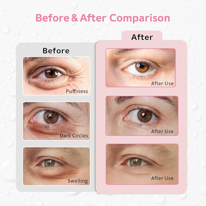 4PCS Gel Eye Ice Pack Set, Cold & Hot Compress, Reusable Cooling Gel Pads for Strain Relief, Relaxation, SPA and sleep(Butterflies)