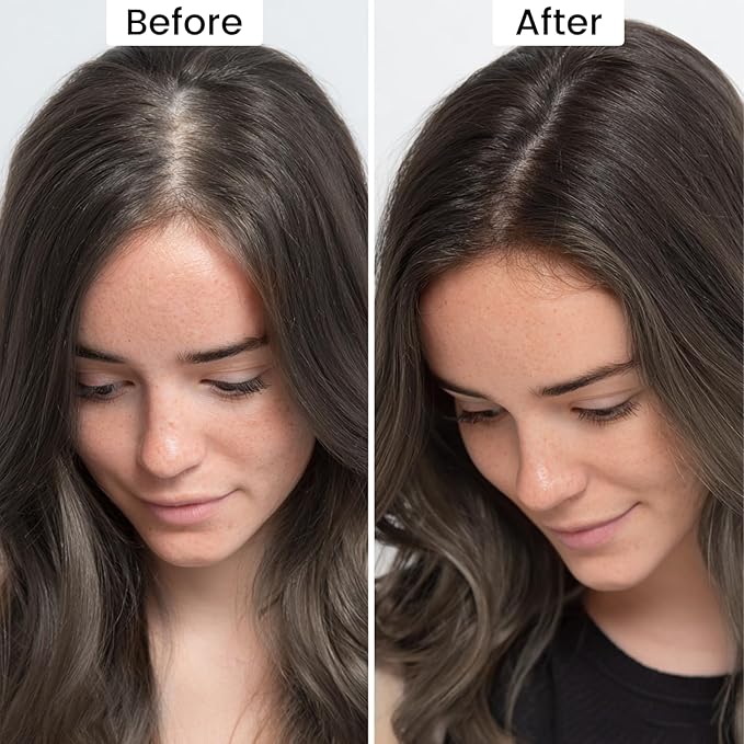 VOLLUCK Root Touch up Powder, Instant Hairline Powder for Thinning Areas and Gray Hair Coverage, Natural and Non-greasy Root Cover up for Women and Men (Dark Brown, 0.14 Ounce)
