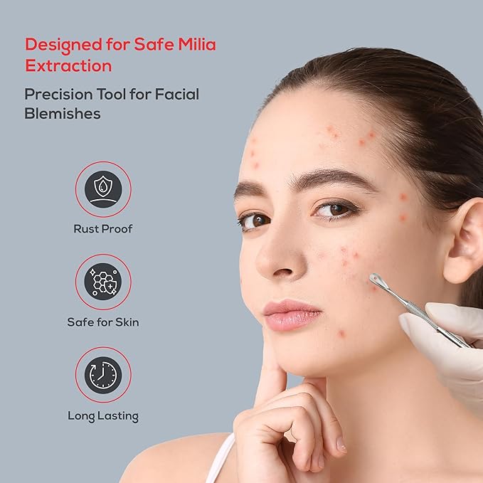 Suvorna Skinpal Milia Remover, Milia Extractor, Acne Needle, Cyst Removal, Blackhead and Whitehead Removal, Pimple Popper Tool, Pimple Extractor, Blemish Remover Tool and Comedone Extractor.