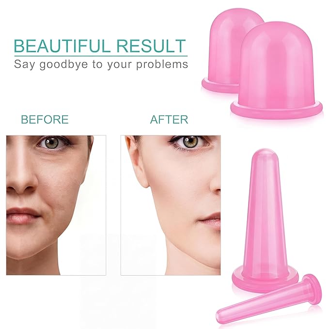 BBTO Silicone Facial Cupping Set, Vacuum Massage Cup Kit for Body, Face, Neck, Back, and Eye, 6 Cups and Exfoliating Brush (Translucent Pink)