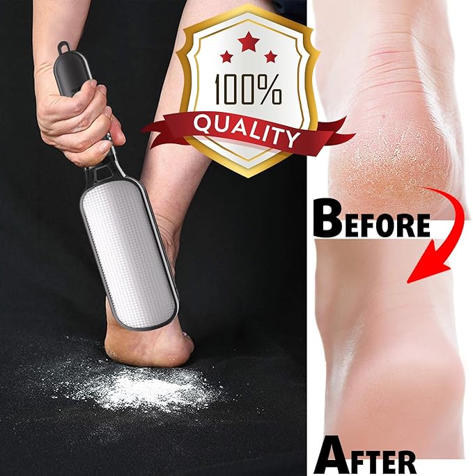 Antonki Foot File for Dead Skin, Double Sided Callus Remover for Feet, Metal Foot Scrubber for Cracked Heel, Professional Foot Scraper Rasp Pedicure Tool to Remove Hard Skin - 2 in 1 Foot File
