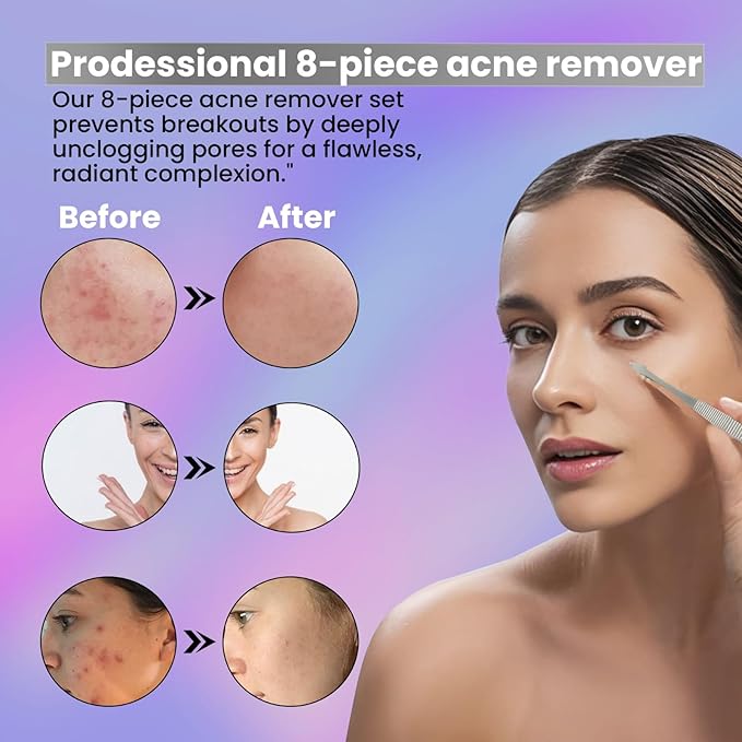Acne Needle Blackhead Remover Pimple Blemish Comedone Extractor Tweezer Tool Kit