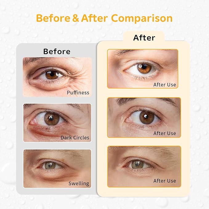 4PCS Gel Eye Ice Pack Set, Cold & Hot Compress, Reusable Cooling Gel Pads for Strain Relief, Relaxation, SPA and Sleep (4 Oranges-2)
