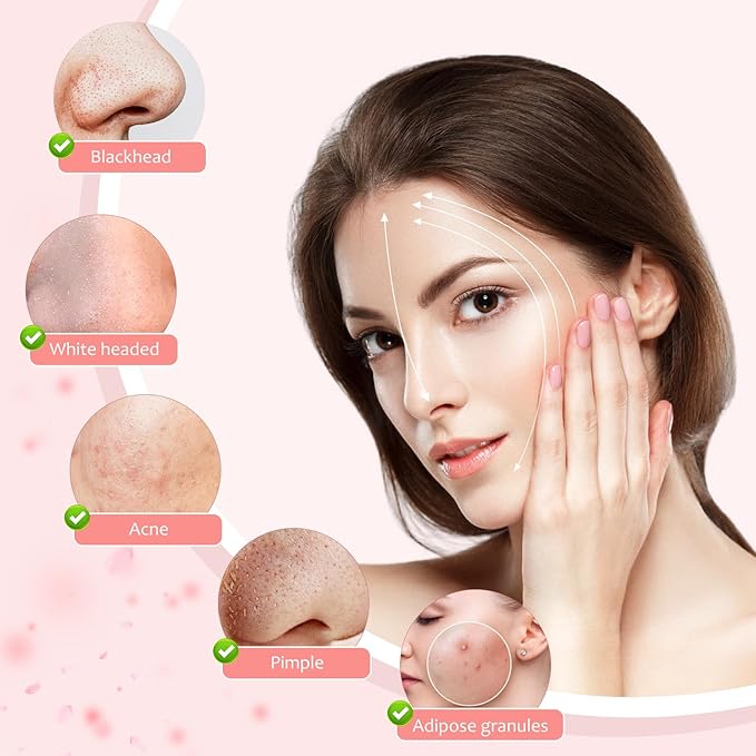 10 PCS Professional Stainless Steel Blackhead Remover,Rose Gold Pimple Popper Tool Kit,Comedones Extractor Tools for Removing Pimple,Whiteheads,Acne,Zit,Fat Granules