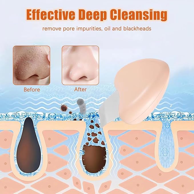 1 Pcs Blackhead Remover Tools, Silicone Face Scraper for Deep Cleansing, Nose Blackhead Remover for Women Men - Heart-Shaped - Beige