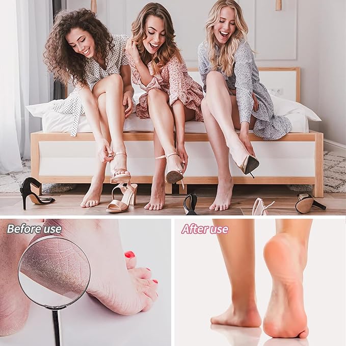 Foot File for Dead Skin - Dual Sided Foot Rasp Callus Removers, Professional Pedicure Tool for Soft, Smooth Feet (Pink)