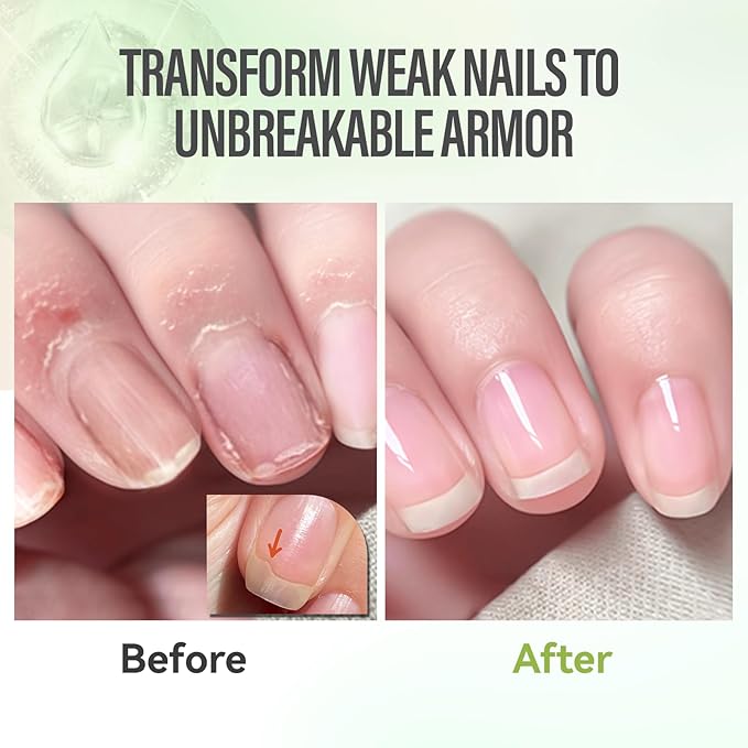 CHUCHU Nail Growth and Strengthener Oil for Cuticle - Aloe Vera Scent Cuticle Oil Repair Moisturizing Treatment - Natural Jojoba Vitamin B & E Nail Oil for Dry Cracked Nails