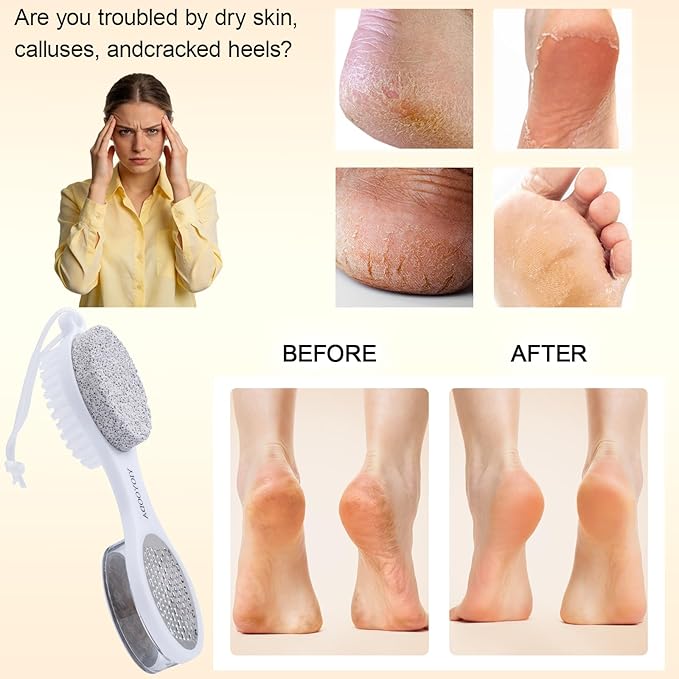 Foot Scrubber Brush with Pumice Stone for Feet 5-in-1, 2Pcs Foot File Callus Remover, Stainless Steel Feet Scraper, Cleaning Brush & Sand Paper Debris Catcher, Multi Purpose Home Foot Care, Pink White