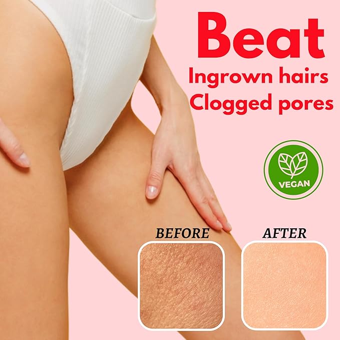 Bikini Area Exfoliator Pack 2-2% Kojic Acid Vitamin C & 7% AHA/BHA Even Skin Tone, Radiance & Glow Skin & Ingrown Hair for Rectum Intimate Butt Underarm