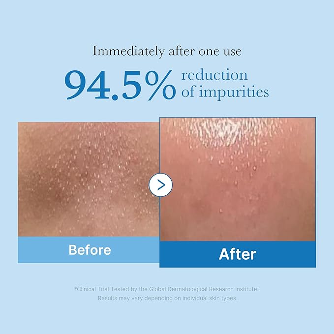medicube Zero Pore Blackhead Cleansing Oil | Makeup Remover for all skin types, Daily Moisture Facial Cleanser, Low-Irritation | Korean Skin Care (205ml / 6.93 fl.oz)