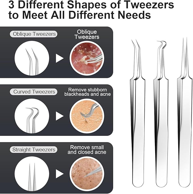 Pimple Popper Tool kit Blackhead Remover Comedone Extractor Kit with Box for Easily Remove blackheads, Acne, Blemishes, Whiteheads, pimples and Papules from the face and Bonus Gift -6pcs