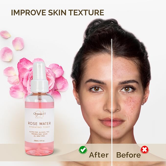 Rose Water Hydrating Toner Spray – Organic Aloe Vera & Hibiscus Face Mist, Alcohol Free & Dermatologist Tested for Sensitive & All Skin Types – 120ml